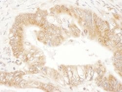 CaMKK2 Rabbit anti-Human, Polyclonal, Bethyl Laboratories 10 &mu;L; Unconjugated:Antibodies,