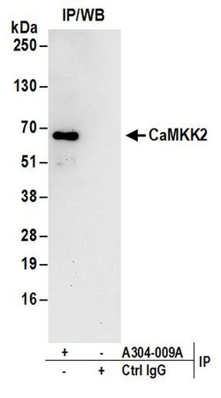 CaMKK2 Rabbit anti-Human, Polyclonal, Bethyl Laboratories 10 &mu;L; Unconjugated:Antibodies,