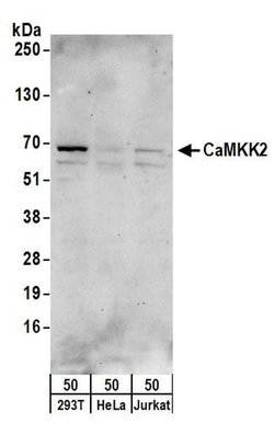 CaMKK2 Rabbit anti-Human, Polyclonal, Bethyl Laboratories 10 &mu;L; Unconjugated:Antibodies,