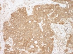 CacyBP Rabbit anti-Human, Mouse, Polyclonal, Bethyl Laboratories 100 &mu;L;