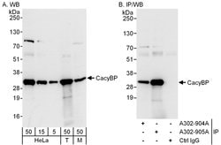 CacyBP Rabbit anti-Human, Mouse, Polyclonal, Bethyl Laboratories 100 &mu;L;