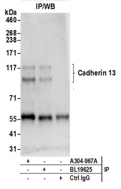 Cadherin 13/CDH13/T-cadherin Rabbit anti-Human, Polyclonal, Bethyl Laboratories