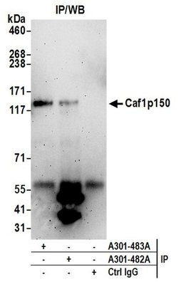 Caf1p150 Rabbit anti-Human, Polyclonal, Bethyl Laboratories 100 &mu;L;