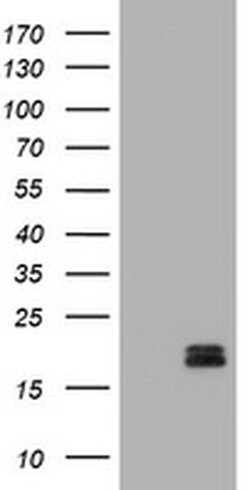 Calcitonin (CALCA) Mouse anti-Human, Clone: OTI11H8, liquid, TrueMAB 100 &mu;L | Buy Online | Origene Technologies | Fisher Scientific
