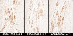 Caldesmon Rabbit anti-Human, Polyclonal, Bethyl Laboratories 100 &mu;L;