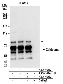 Caldesmon Rabbit anti-Human, Polyclonal, Bethyl Laboratories 100 &mu;L;