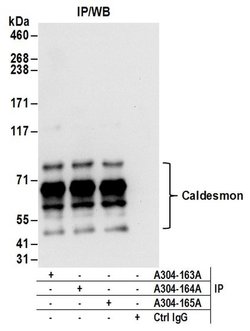 Caldesmon Rabbit anti-Human, Polyclonal, Bethyl Laboratories 100 &mu;L | Buy Online | Bethyl Laboratories, Inc | Fisher Scientific