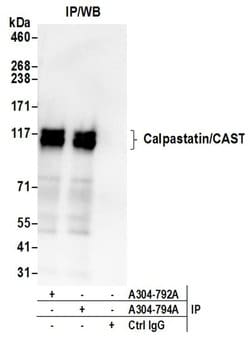 Calpastatin/CAST Rabbit anti-Human, Polyclonal, Bethyl Laboratories 10