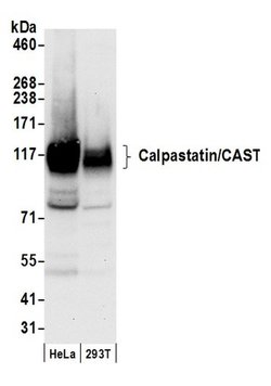 Calpastatin/CAST Polyclonal Antibody, Bethyl Laboratories 20 &mu;L | Buy Online | Bethyl Laboratories, Inc | Fisher Scientific