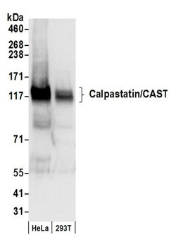 Calpastatin/CAST Polyclonal Antibody, Bethyl Laboratories:Antibodies:Primary