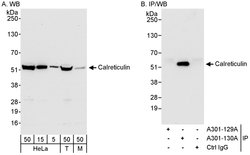 Calreticulin Rabbit anti-Human, Mouse, Polyclonal, Bethyl Laboratories