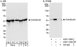Calreticulin Rabbit anti-Human, Mouse, Polyclonal, Bethyl Laboratories