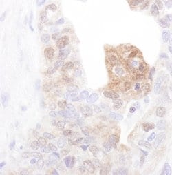 CamK4 Rabbit anti-Human, Polyclonal, Bethyl Laboratories 100 &mu;L; Unconjugated:Antibodies,