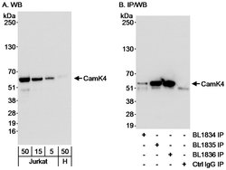 CamK4 Rabbit anti-Human, Polyclonal, Bethyl Laboratories 100 &mu;L; Unconjugated:Antibodies,