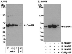 CamK4 Rabbit anti-Human, Polyclonal, Bethyl Laboratories 100 &mu;L; Unconjugated:Antibodies,