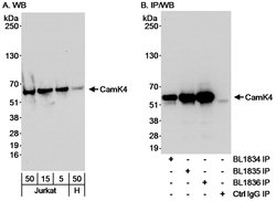 CamK4 Rabbit anti-Human, Polyclonal, Bethyl Laboratories 100 &mu;L; Unconjugated:Antibodies,