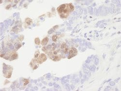 CamK4 Polyclonal Antibody, Bethyl Laboratories 100 &mu;L; Unconjugated:Antibodies,