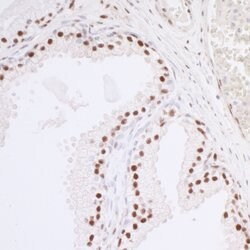 Caper Rabbit anti-Human, Polyclonal, Bethyl Laboratories 100 &mu;L; Unconjugated:Antibodies,