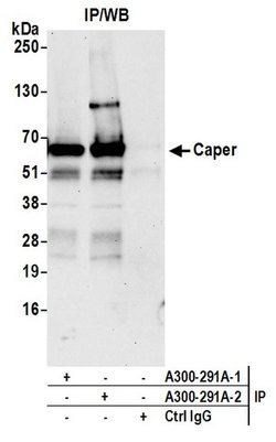 Caper Rabbit anti-Human, Polyclonal, Bethyl Laboratories 100 &mu;L; Unconjugated:Antibodies,
