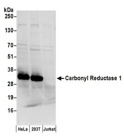 Carbonyl Reductase 1/CBR1 Rabbit anti-Human, Polyclonal, Bethyl Laboratories
