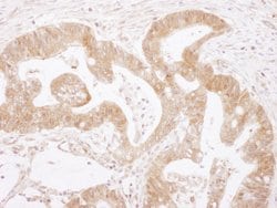 Caspase 3 Rabbit anti-Human, Polyclonal, Bethyl Laboratories 100 &mu;L;
