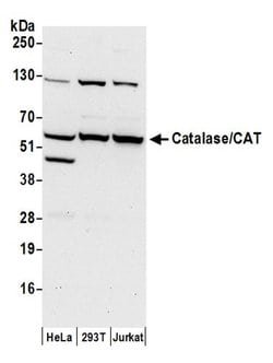 Catalase/CAT Polyclonal Antibody, Bethyl Laboratories 20 &mu;L | Buy Online | Bethyl Laboratories, Inc | Fisher Scientific