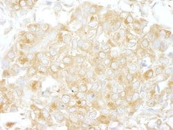 Cdc42GAP Rabbit anti-Human, Mouse, Polyclonal, Bethyl Laboratories 100
