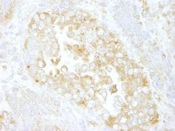 Cdc42GAP Polyclonal Antibody, Bethyl Laboratories:Antibodies:Primary Antibodies