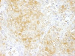 Cdc42GAP Polyclonal Antibody, Bethyl Laboratories 10 &mu;L; Unconjugated:Antibodies,