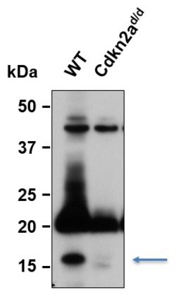 Invitrogen p16INK4a Polyclonal Antibody 100 &mu;L; Unconjugated:Antibodies,