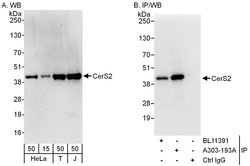 CerS2 Rabbit anti-Human, Polyclonal, Bethyl Laboratories 100 &mu;L; Unconjugated:Antibodies,