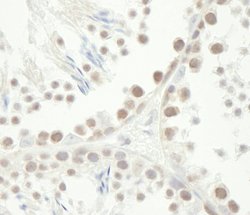 Chk1 Polyclonal Antibody, Bethyl Laboratories 10 &mu;L | Buy Online | Bethyl Laboratories, Inc | Fisher Scientific