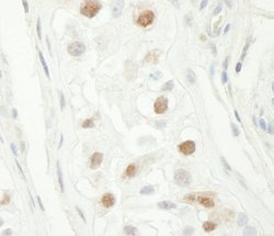 Chk1 Polyclonal Antibody, Bethyl Laboratories 10 &mu;L | Buy Online | Bethyl Laboratories, Inc | Fisher Scientific