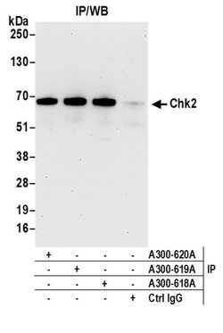 Chk2 Rabbit anti-Human, Polyclonal, Bethyl Laboratories 100 &mu;L; Unconjugated:Antibodies,