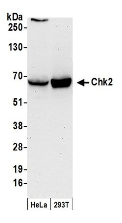 Chk2 Rabbit anti-Human, Polyclonal, Bethyl Laboratories 100 &mu;L; Unconjugated:Antibodies,