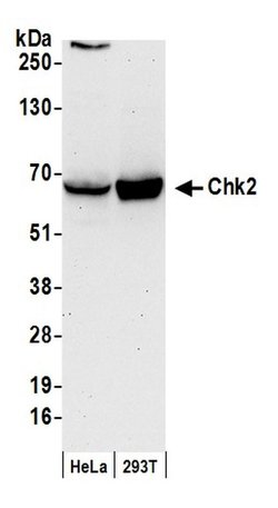 Chk2 Polyclonal Antibody, Bethyl Laboratories 20 &mu;L; Unconjugated:Antibodies,