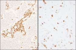 Coronin 1 Rabbit anti-Human, Mouse, Polyclonal, Bethyl Laboratories 100