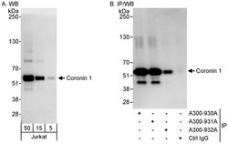Coronin 1 Rabbit anti-Human, Mouse, Polyclonal, Bethyl Laboratories 100
