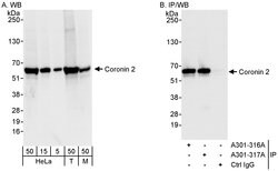 Coronin 2 Rabbit anti-Human, Mouse, Polyclonal, Bethyl Laboratories 100