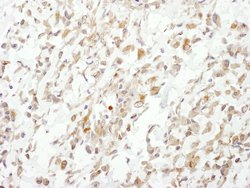 Cul1 Rabbit anti-Human, Polyclonal, Bethyl Laboratories 10 &mu;L; Unconjugated:Antibodies,