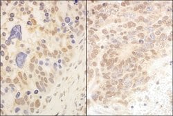 Cul2 Rabbit anti-Human, Polyclonal, Bethyl Laboratories 10 &mu;L; Unconjugated:Antibodies,