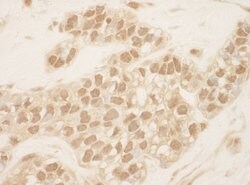 Cul2 Polyclonal Antibody, Bethyl Laboratories 100 &mu;l; Unlabeled:Antibodies,