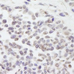 Cul3 Polyclonal Antibody, Bethyl Laboratories 100 &mu;L; Unconjugated:Antibodies,