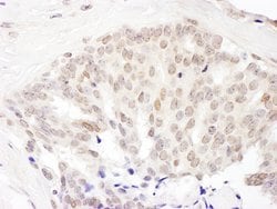 Cul5 Rabbit anti-Human, Mouse, Polyclonal, Bethyl Laboratories 100 &mu;L;