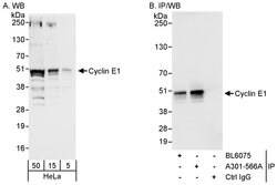 Cyclin E1 Rabbit anti-Human, Polyclonal, Bethyl Laboratories 100 &mu;L;
