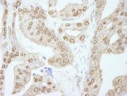 Cyclin E1 Polyclonal Antibody, Bethyl Laboratories:Antibodies:Primary Antibodies