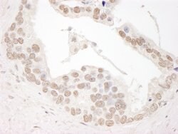 Cyclin L1 Rabbit anti-Human, Polyclonal, Bethyl Laboratories 100 &mu;L;