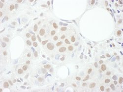 Cyclin T1 Rabbit anti-Human, Polyclonal, Bethyl Laboratories 100 &mu;L;