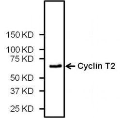Invitrogen Cyclin T2 Polyclonal Antibody 100 &mu;L; Unconjugated:Antibodies,