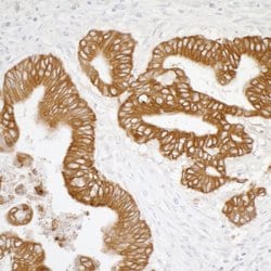 Cytokeratin Mouse anti-Human, Clone: AE1/AE3, Bethyl Laboratories 100 &mu;l;